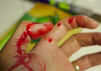Who To Turn To After Suffering An Injury At Work