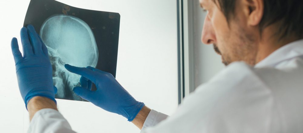 Possible link between football and dementia show impact of industrial diseases